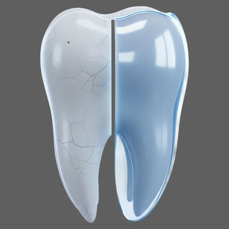 healthy-broken-tooth-before-after-3d