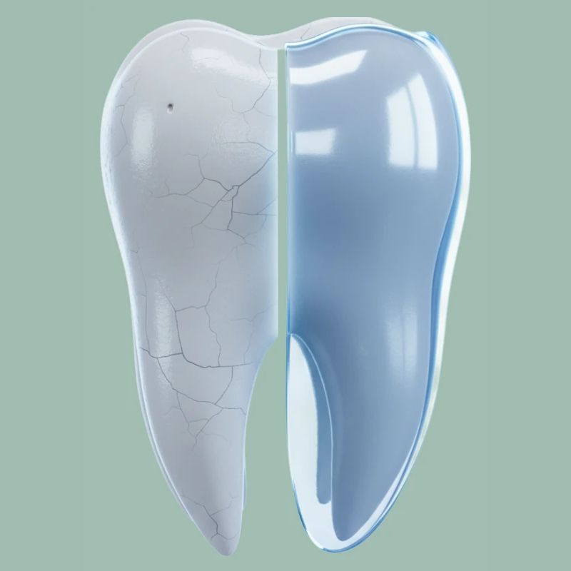 gesunder-kaputter-zahn-vorher-nachher-3d