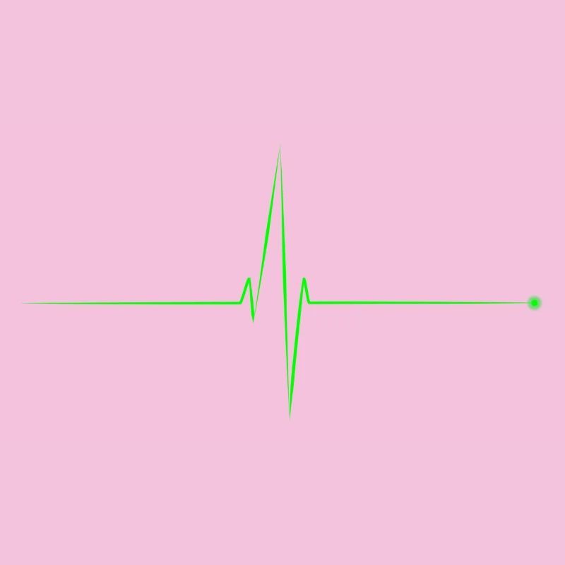 electrocardiogram