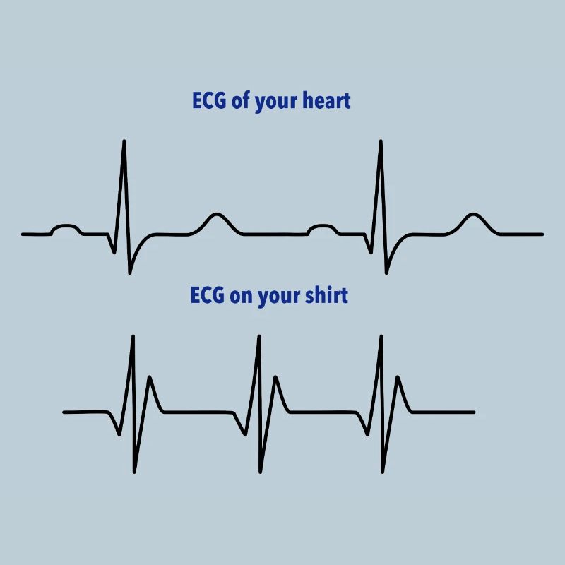 Électrocardiogramme (ECG) rythme réel vs mode