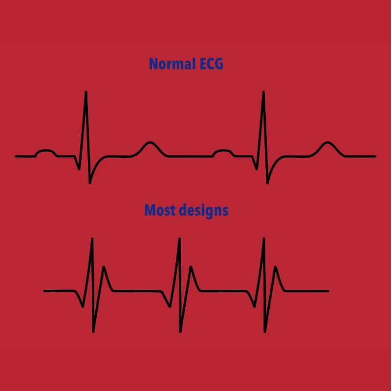 ECG normal vs ECG de conception