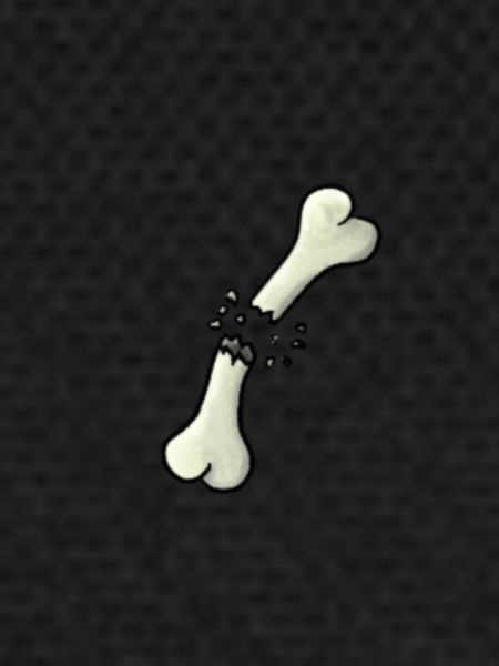 Broken bone
