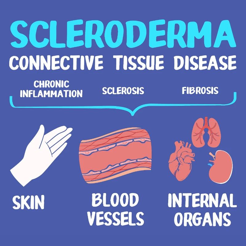 Scleroderma