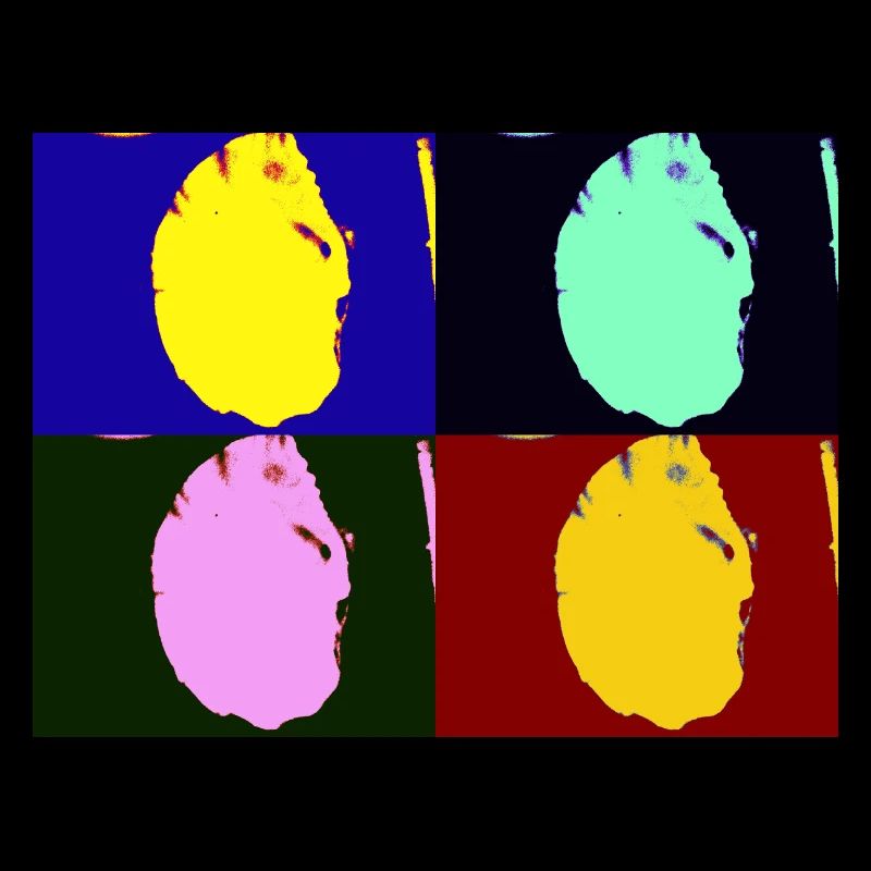 Shell head