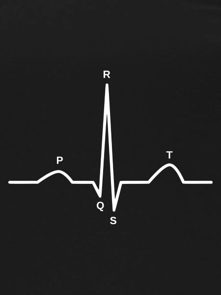 ekg sinus rythmus