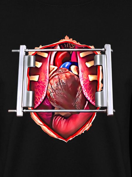 Open chest