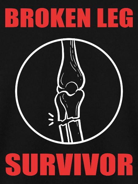 Broken leg