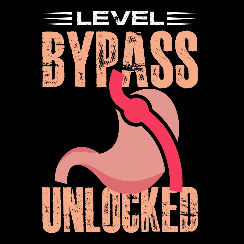 Dérivation de niveau déverrouillée déverrouillée