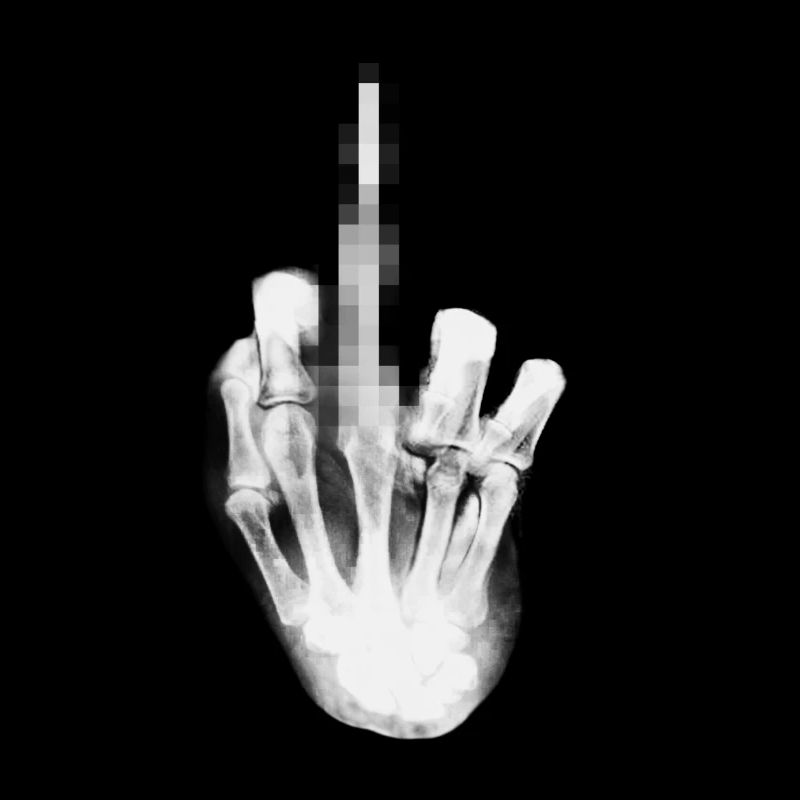 Fuck you