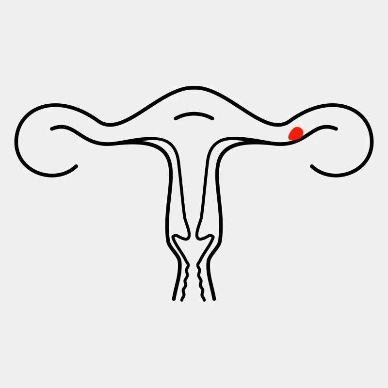 Schematische Gebärmutter (2c)