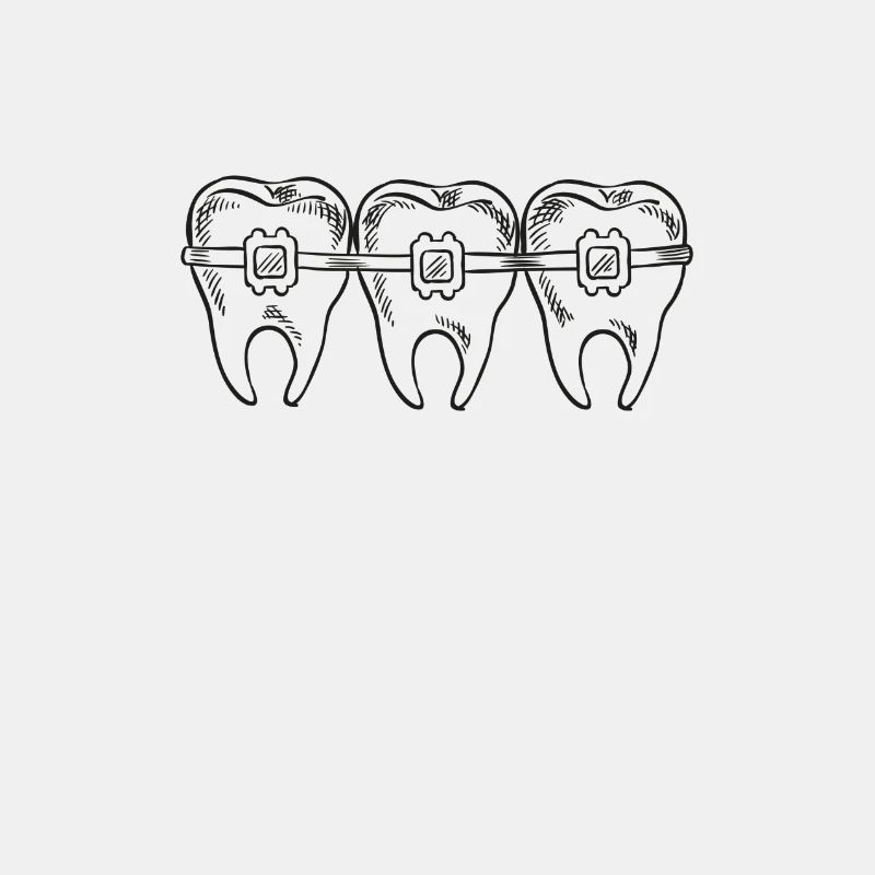 Brackets Feste Spange