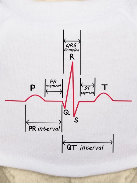 Ecg