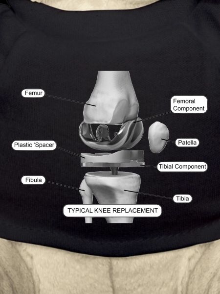 Knee components