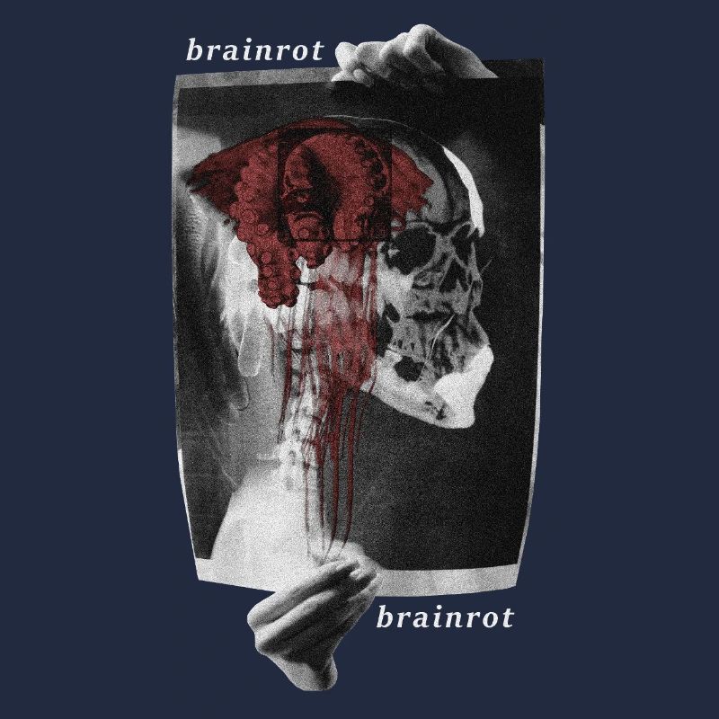 Brainrot