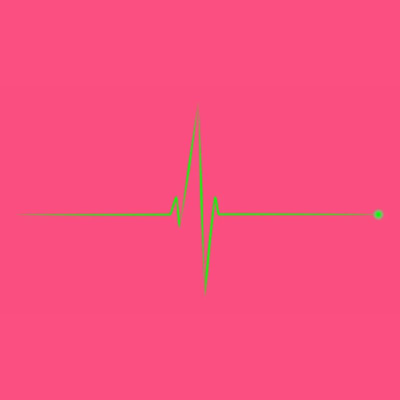 electrocardiogram