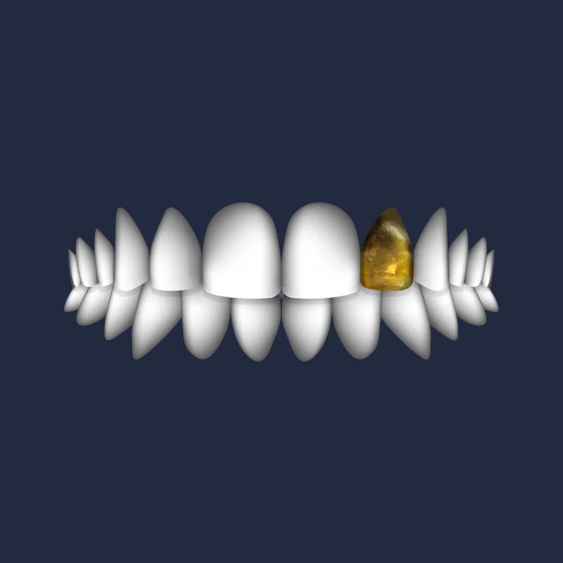 teeth with gold tooth