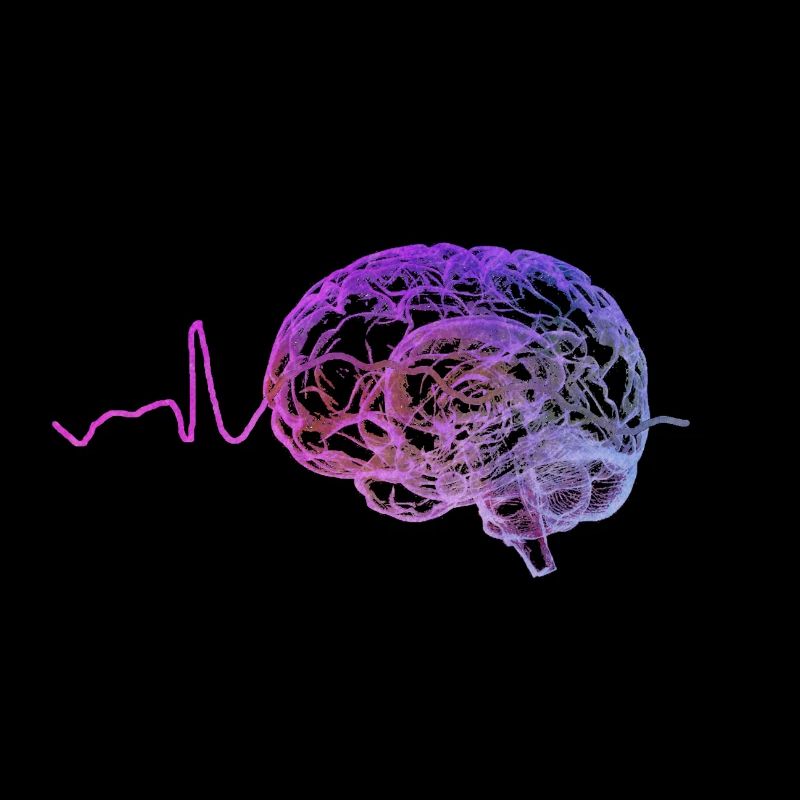 EEG Sharp Wave