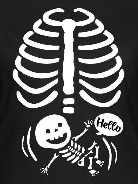 Radiographie de bébé