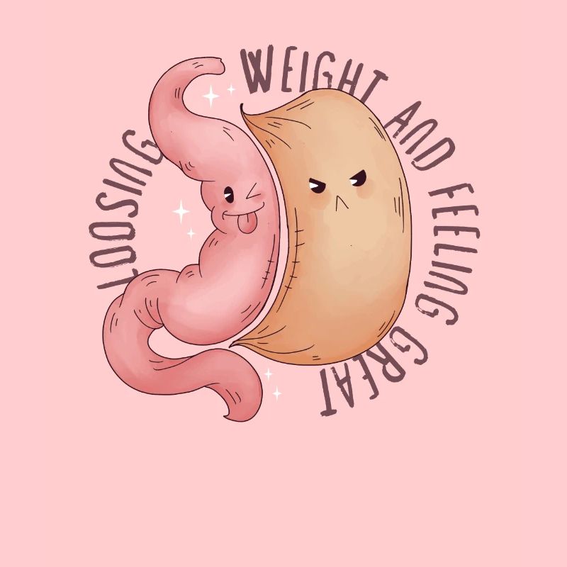 Sleeve gastrectomy sleeve gastrectomy
