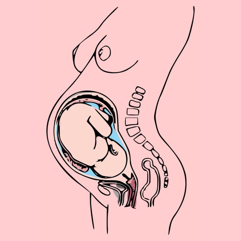 enceinte