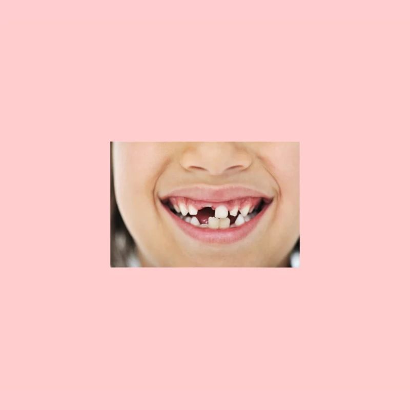 Baby teeth