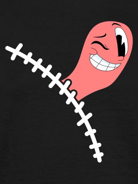 Appendectomy Appendicitis
