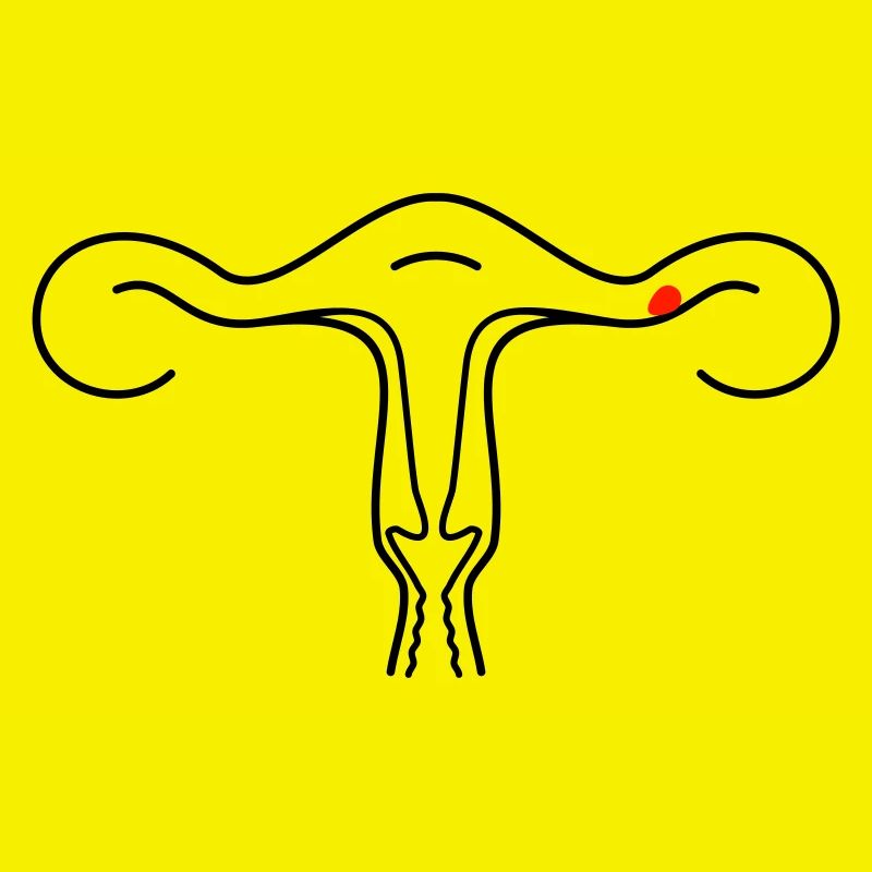Schematic uterus (2c)