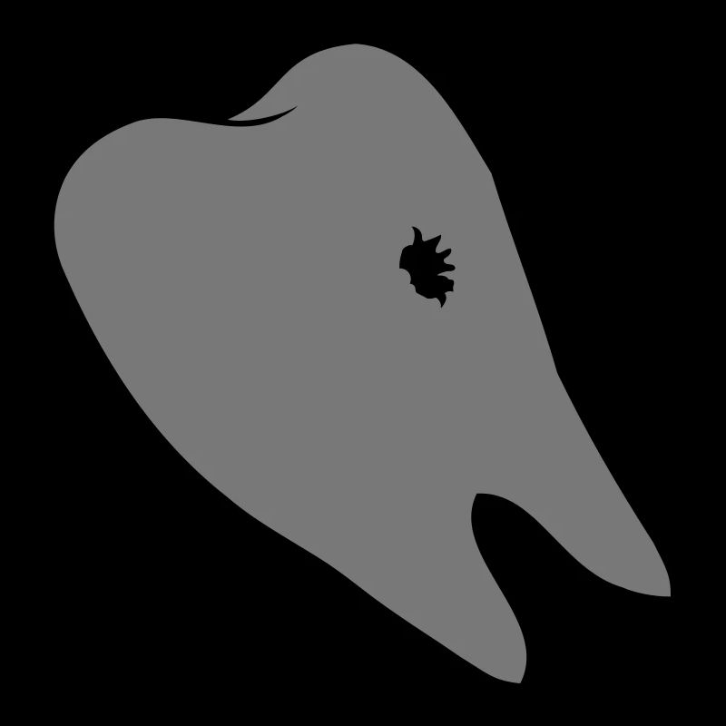 Caries hole tooth