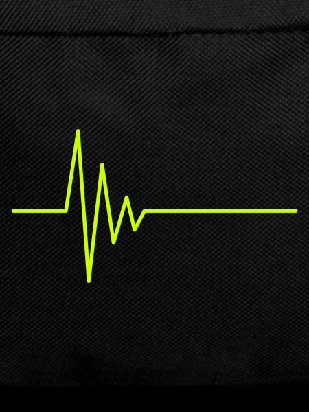 EKG heartbeat