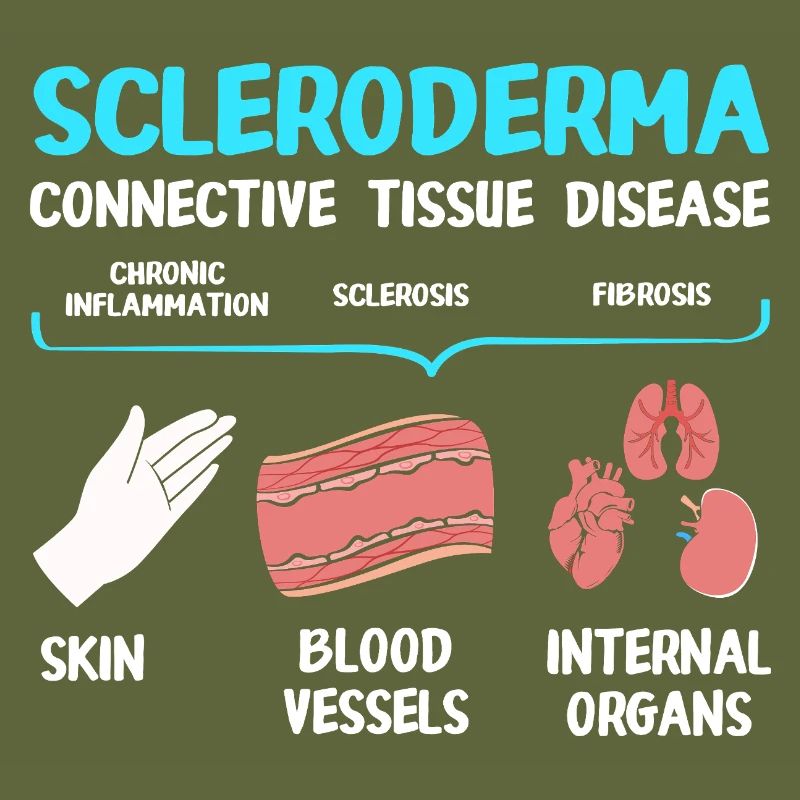 Scleroderma