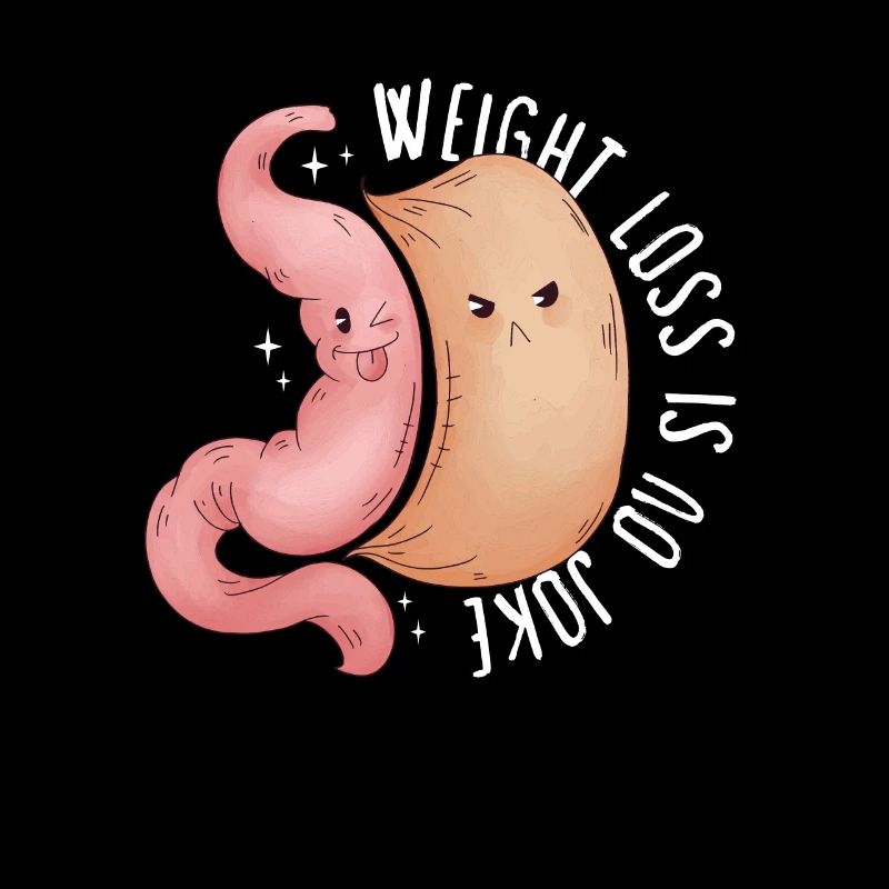 Sleeve gastrectomy sleeve gastrectomy