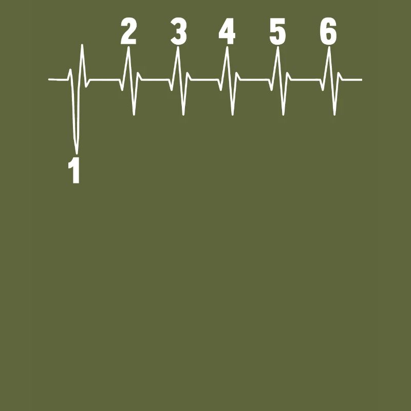 Motorcycle Speed
