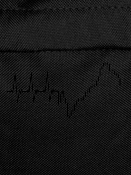 HeartbeatTrader