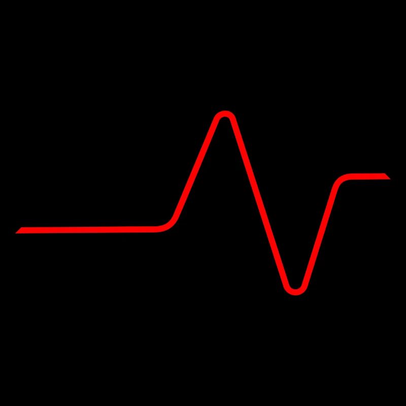 ECG