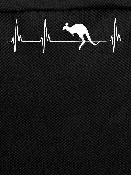 Kangaroo EKG