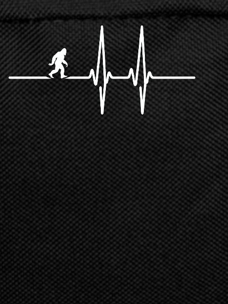 Bigfoot Heartbeat ECG