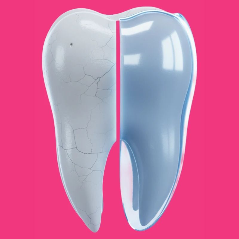 gesunder-kaputter-zahn-vorher-nachher-3d