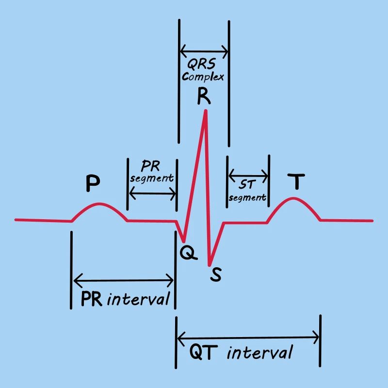ECG