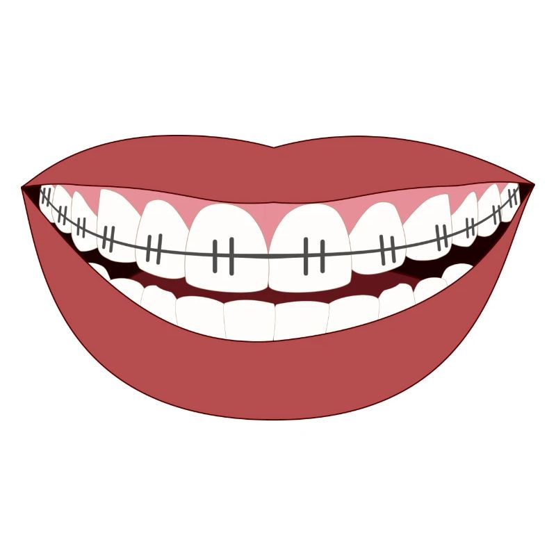 Stahlzähne - Lächeln der Hölle oder Eisen!