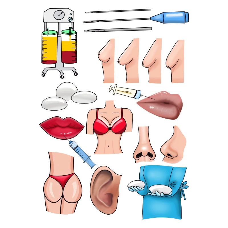 Plastic surgery