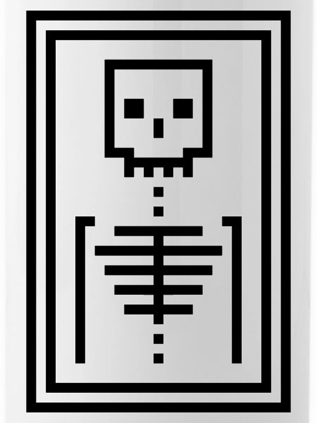Bones
