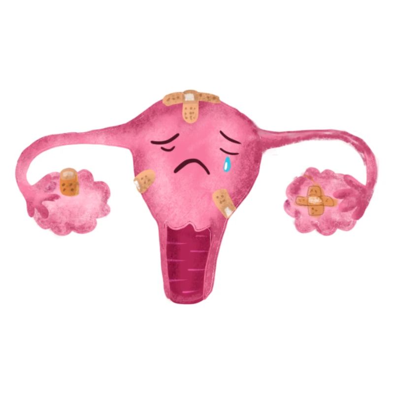 Uterus