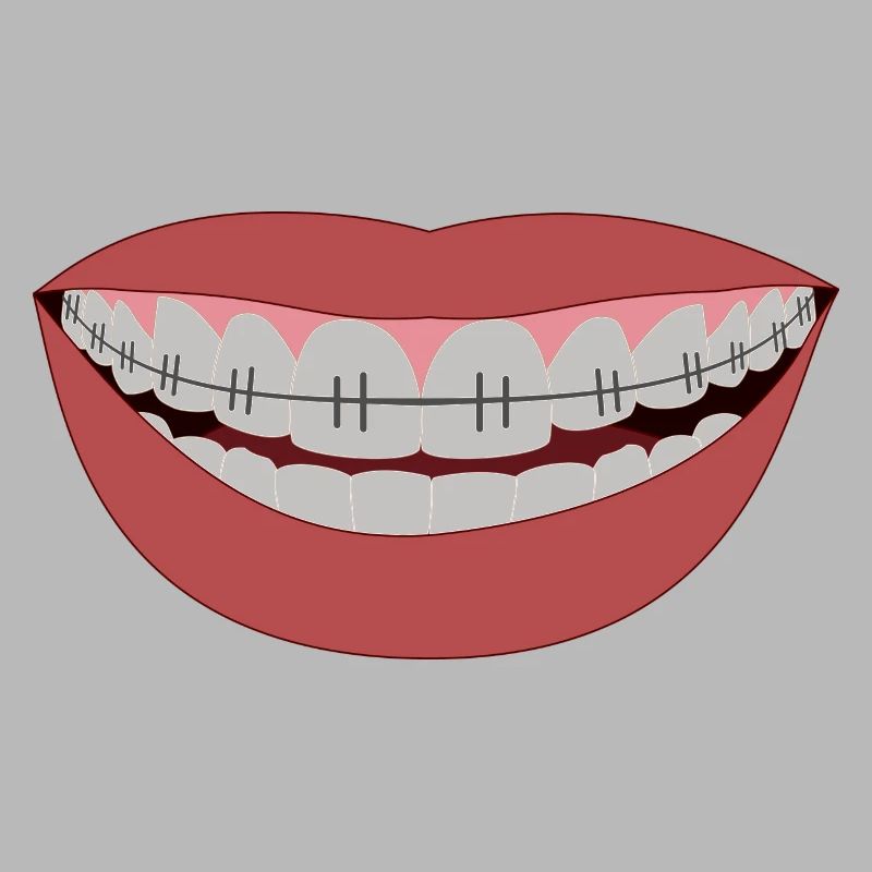 Stahlzähne - Lächeln der Hölle oder Eisen!