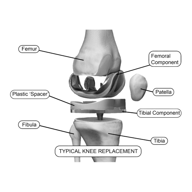 Knee components