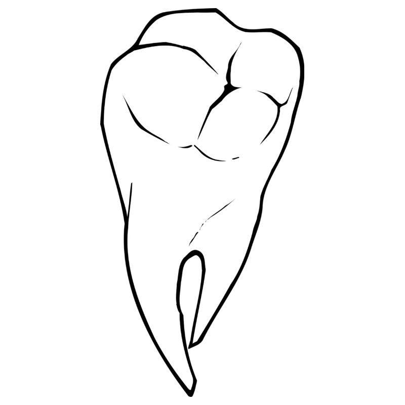 dent