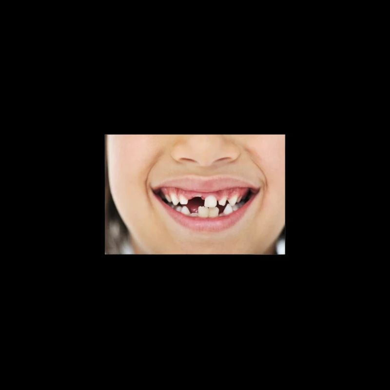 Dents de lait