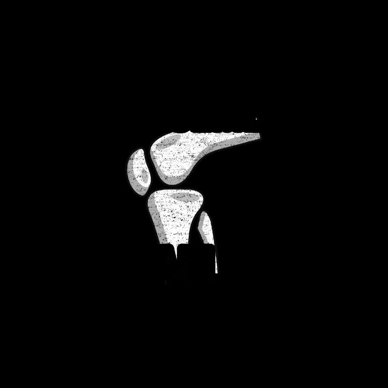 Knee Replacement Performance Upgrade Surgery Funny