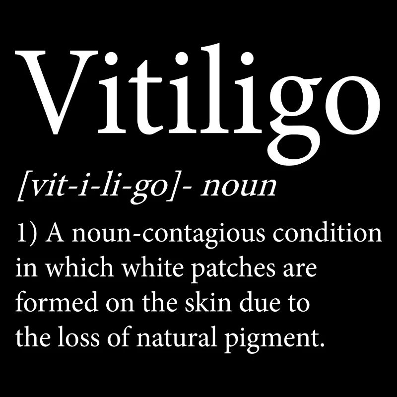 Vitiligo Definition