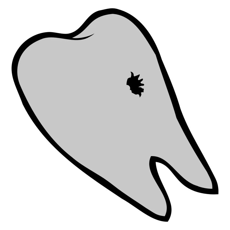 Caries hole tooth