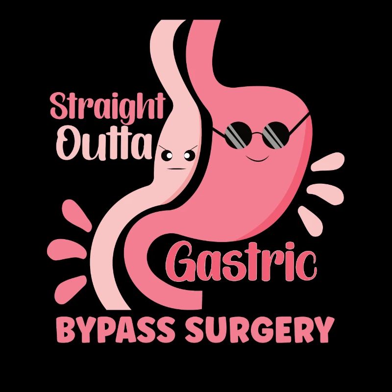 Sleeve gastrectomy Sleeve gastrectomy